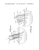 IMPLANTABLE FLOW CONNECTOR diagram and image