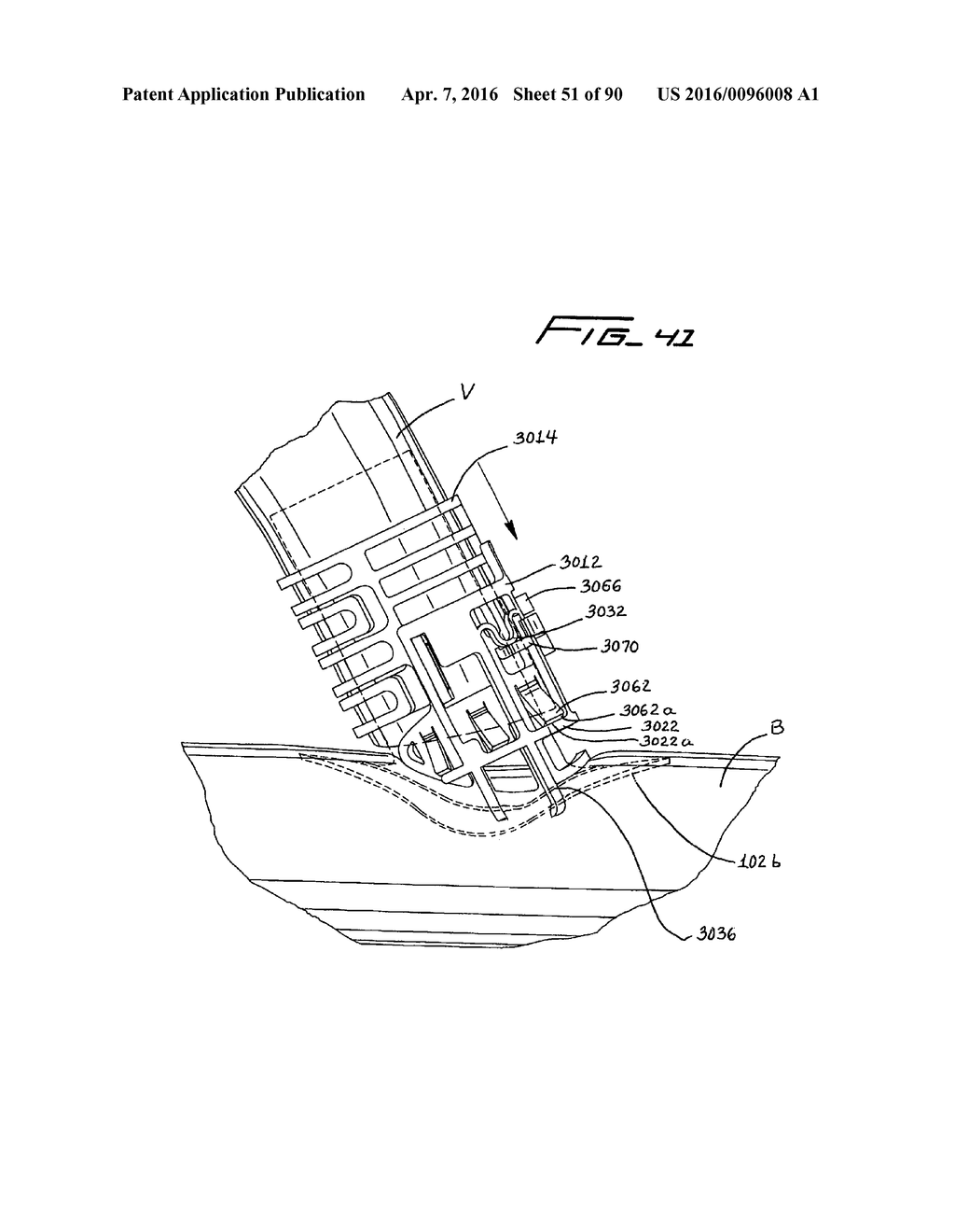 IMPLANTABLE FLOW CONNECTOR - diagram, schematic, and image 52