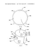 IMPLANTABLE FLOW CONNECTOR diagram and image