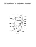 IMPLANTABLE FLOW CONNECTOR diagram and image