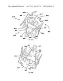 IMPLANTABLE FLOW CONNECTOR diagram and image