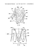 IMPLANTABLE FLOW CONNECTOR diagram and image