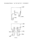 IMPLANTABLE FLOW CONNECTOR diagram and image