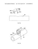 IMPLANTABLE FLOW CONNECTOR diagram and image