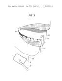 TEETH SURFACE STAIN REMOVING APPARATUS AND TEETH SURFACE STAIN REMOVING     METHOD diagram and image