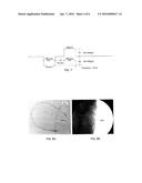 EXTREMELY LOW DUTY-CYCLE ACTIVATION OF THE CHOLINERGIC ANTI-INFLAMMATORY     PATHWAY TO TREAT CHRONIC INFLAMMATION diagram and image