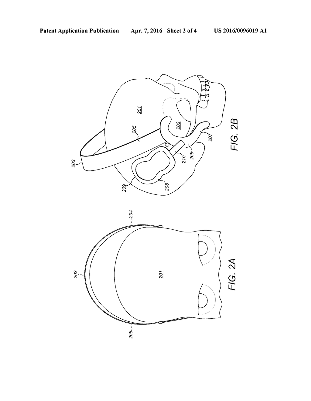 Template for Bilateral Symmetric Stimulator Fixation/Implantation - diagram, schematic, and image 03