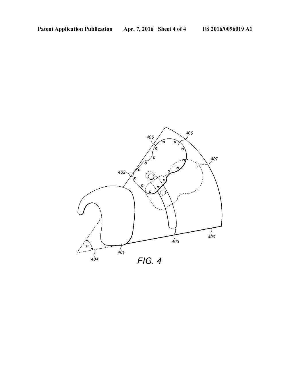 Template for Bilateral Symmetric Stimulator Fixation/Implantation - diagram, schematic, and image 05