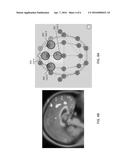 Enhanced Spatial Summation for Deep-Brain Transcranial Magnetic     Stimulation diagram and image