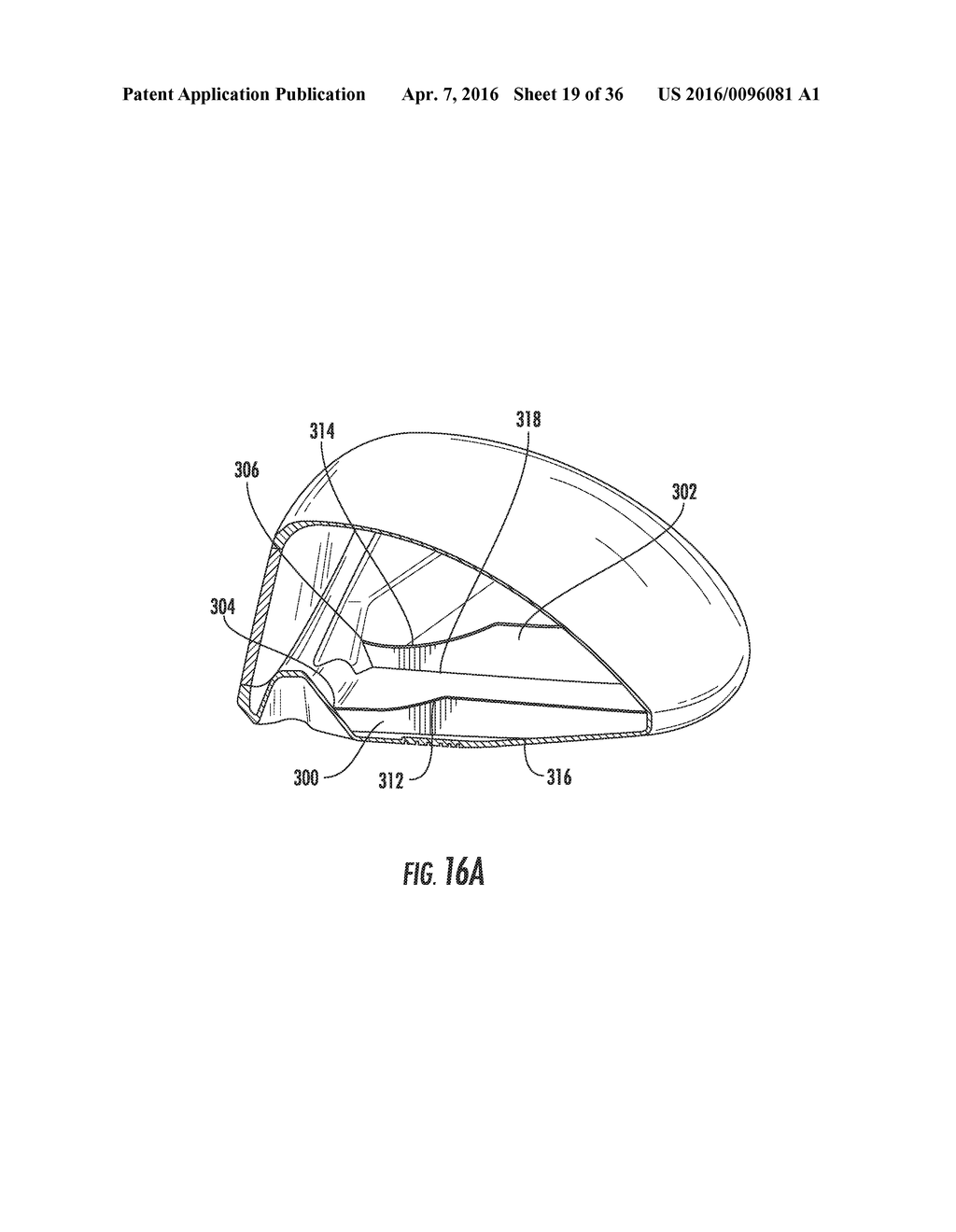 GOLF CLUB HEAD OR OTHER BALL STRIKING DEVICE HAVING IMPACT-INFLUENCING     BODY FEATURES - diagram, schematic, and image 20