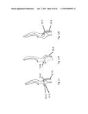 Projectile and Throwing Apparatus and Game for Projectile Throwing diagram and image