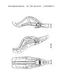 Projectile and Throwing Apparatus and Game for Projectile Throwing diagram and image