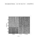 BIOMARKERS FOR THE MOLECULAR CLASSIFICATION OF BACTERIAL INFECTION diagram and image