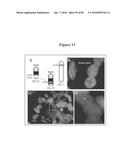 RECURRENT GENE FUSIONS IN PROSTATE CANCER diagram and image