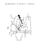 FILL VALVE LEAK PREVENTION SYSTEM diagram and image