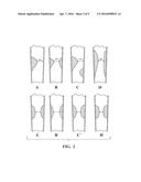 METHOD FOR ASSESSING STENOSIS SEVERITY IN A LESION TREE THROUGH STENOSIS     MAPPING diagram and image