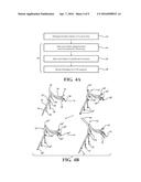 METHOD FOR ASSESSING STENOSIS SEVERITY IN A LESION TREE THROUGH STENOSIS     MAPPING diagram and image