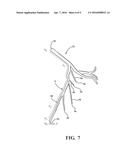 METHOD FOR ASSESSING STENOSIS SEVERITY IN A LESION TREE THROUGH STENOSIS     MAPPING diagram and image