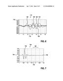 ULTRASOUND PROBE WITH ACOUSTICAL LENS diagram and image