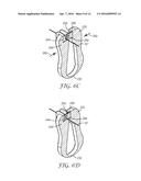 DISPOSABLE OPTICAL FIBER COATING REMOVAL TOOL diagram and image