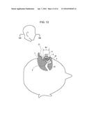 EARPHONE DEVICE diagram and image