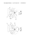 HEARING AID INTERCONNECTION SYSTEM diagram and image