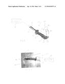 Illuminated Surgical Retractor  System diagram and image