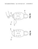 Blood Sample Management Using Open Cell Foam diagram and image