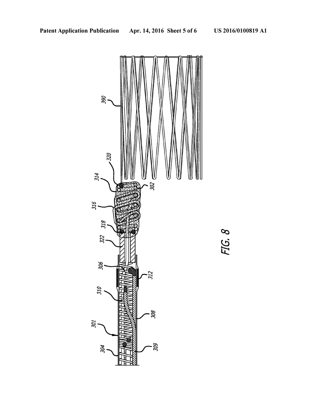 System And Method For Locating Detachment Zone Of A Detachable Implant - diagram, schematic, and image 06