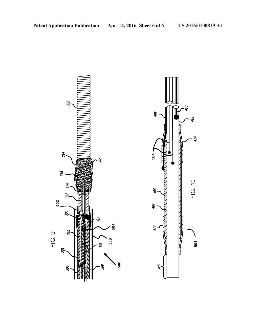 System And Method For Locating Detachment Zone Of A Detachable Implant - diagram, schematic, and image 07