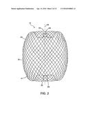 DELIVERY AND DETACHMENT SYSTEMS AND METHODS FOR VASCULAR IMPLANTS diagram and image