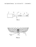 DELIVERY AND DETACHMENT SYSTEMS AND METHODS FOR VASCULAR IMPLANTS diagram and image