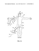 DELIVERY AND DETACHMENT SYSTEMS AND METHODS FOR VASCULAR IMPLANTS diagram and image