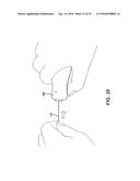 DELIVERY AND DETACHMENT SYSTEMS AND METHODS FOR VASCULAR IMPLANTS diagram and image