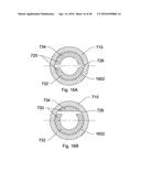 STEERABLE ENDOLUMINAL PUNCH diagram and image