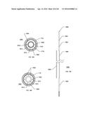 STEERABLE ENDOLUMINAL PUNCH diagram and image