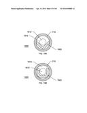 STEERABLE ENDOLUMINAL PUNCH diagram and image