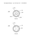 STEERABLE ENDOLUMINAL PUNCH diagram and image