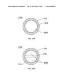 STEERABLE ENDOLUMINAL PUNCH diagram and image