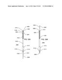 STEERABLE ENDOLUMINAL PUNCH diagram and image