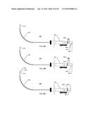 STEERABLE ENDOLUMINAL PUNCH diagram and image