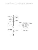 STEERABLE ENDOLUMINAL PUNCH diagram and image