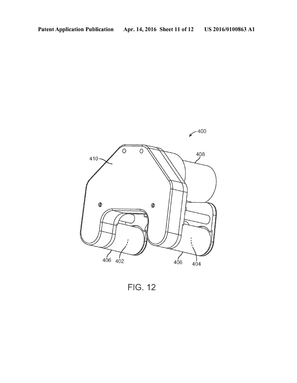 MAINTENANCE FEATURE IN MAGNETIC IMPLANT - diagram, schematic, and image 12