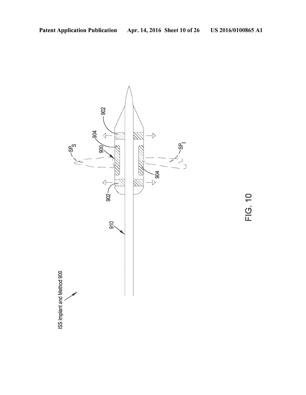 MINIMALLY INVASIVE INTERSPINOUS PROCESS SPACER IMPLANTS AND METHODS - diagram, schematic, and image 11