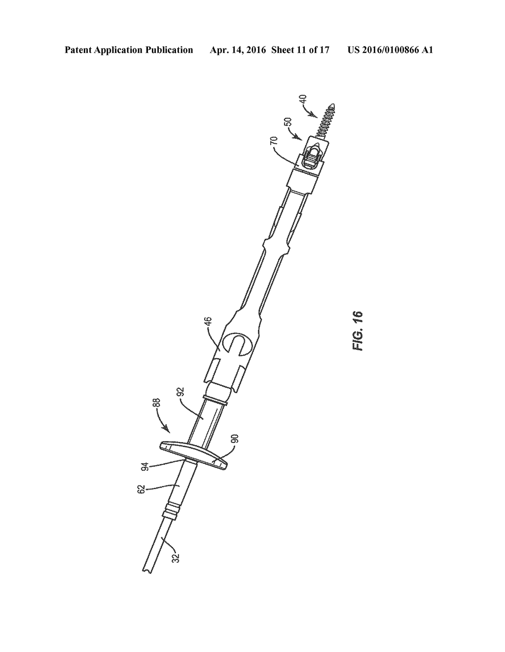 BONE SCREW EXTENDER REATTACHMENT SYSTEM AND METHODS - diagram, schematic, and image 12