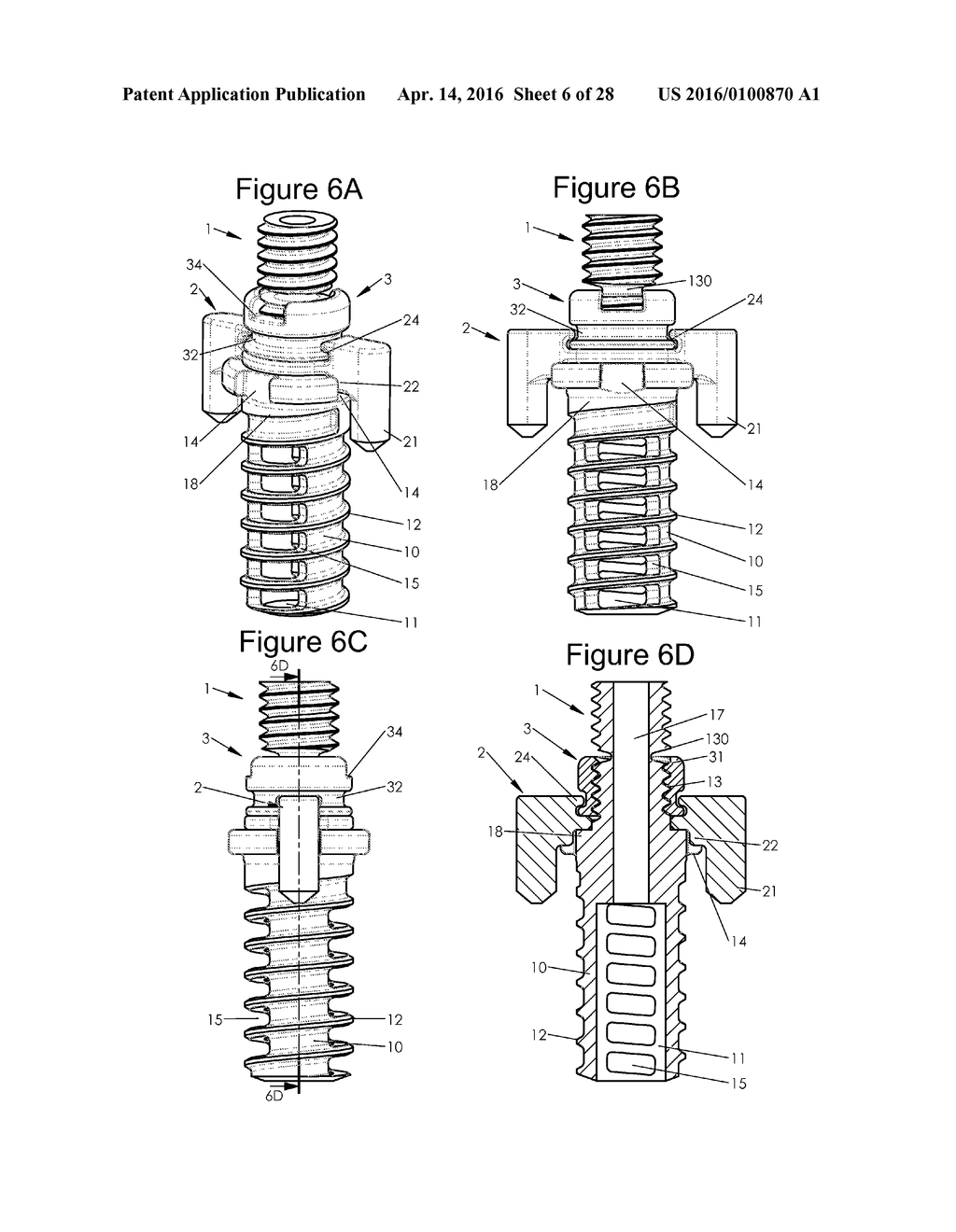 Bone Implants - diagram, schematic, and image 07