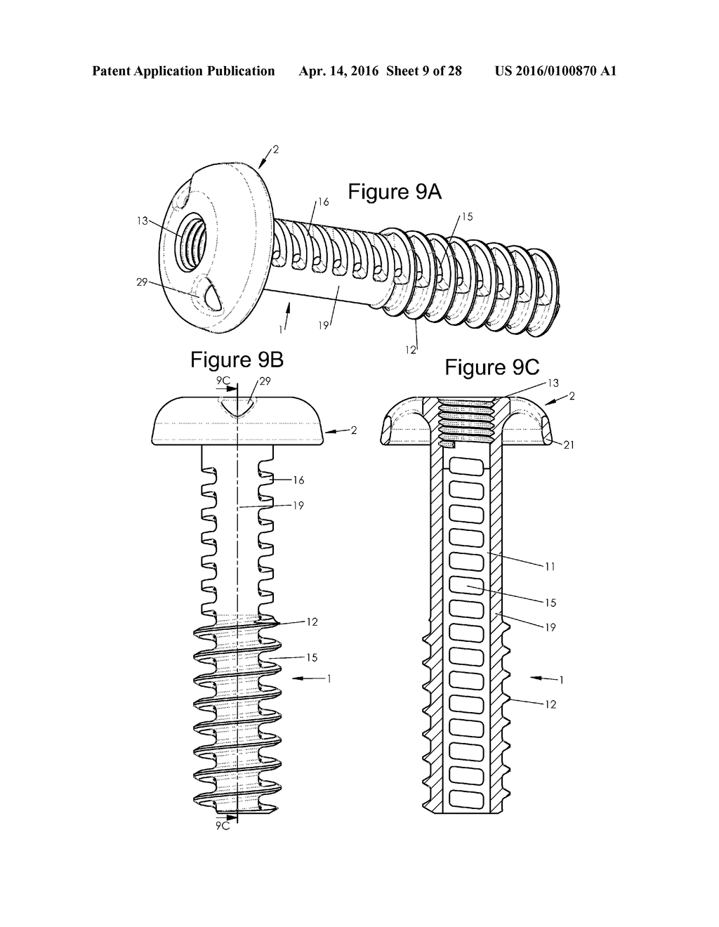 Bone Implants - diagram, schematic, and image 10