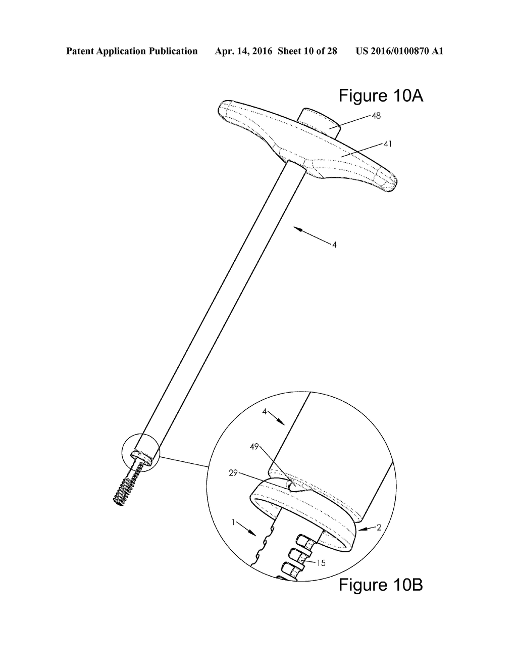 Bone Implants - diagram, schematic, and image 11