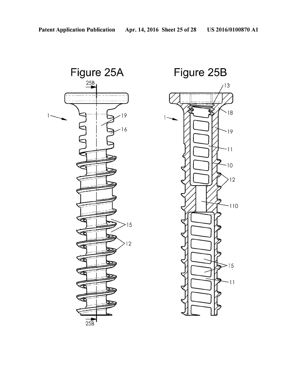 Bone Implants - diagram, schematic, and image 26