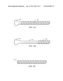 UNIVERSAL ANCHOR FOR ATTACHING OBJECTS TO BONE TISSUE diagram and image